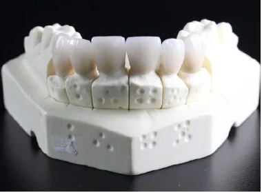 セラミック素材の歯