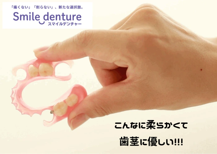 和光市　歯医者　和光市デンタルオフィス　スマイルデンチャー(Smile denture)