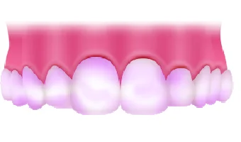 プラーク測定(PCR)イメージ