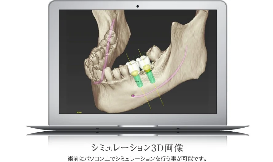 シミュレーション3D画像