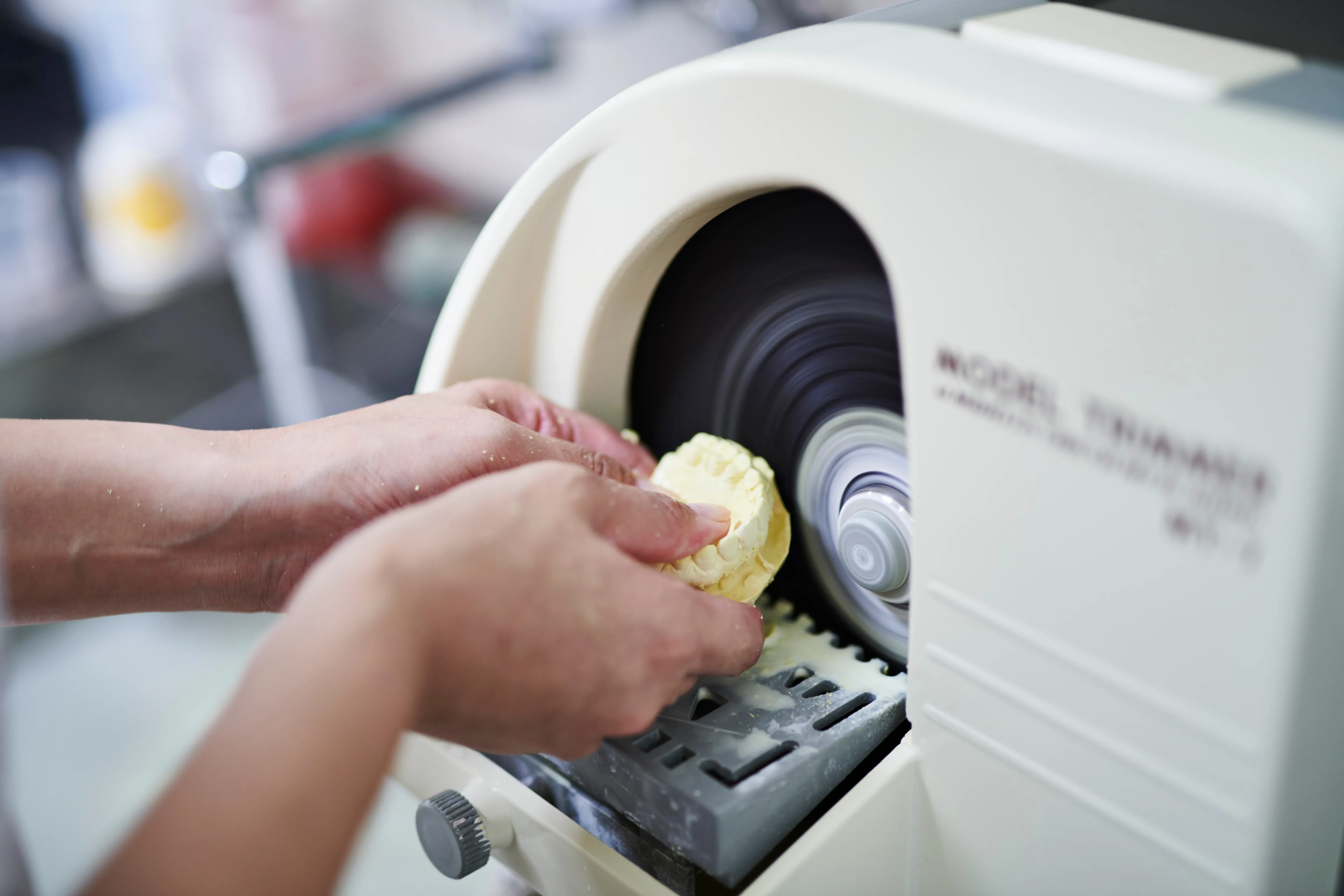 上部構造の製作、完成 和光市 歯医者 和光市歯医者・矯正歯科|和光市デンタルオフィス 上部構造の製作、完成