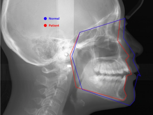 和光市　歯医者　和光市デンタルオフィス　上顎と下顎の大きさ、位置関係の不調和