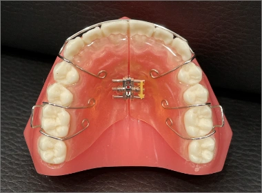 和光市　歯医者　和光市デンタルオフィス　小児矯正のイメージ