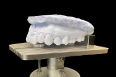 和光市　歯医者　和光市デンタルオフィス　咬合平面模型診断