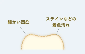 和光市　歯医者　和光市デンタルオフィス　歯の表面の着色汚れ