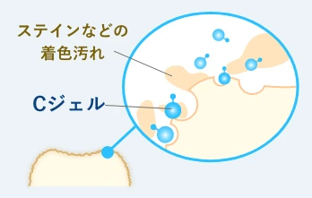 和光市　歯医者　和光市デンタルオフィス　Cジェルによって着色汚れを取り除く