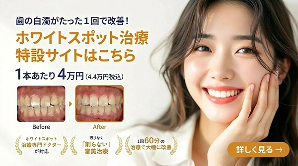 和光市歯医者•矯正歯科|和光市デンタルオフィス ホワイトスポット治療特設サイト