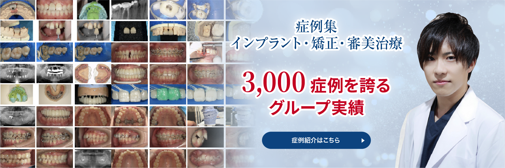 和光市デンタルオフィス 症例紹介