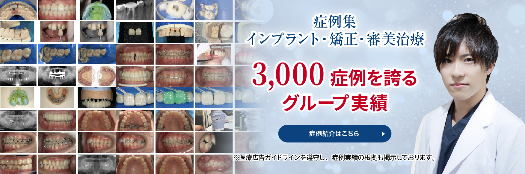 和光市デンタルオフィス 症例紹介
