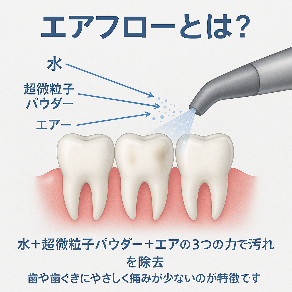 和光市 歯医者 和光市デンタルオフィス エアフロー