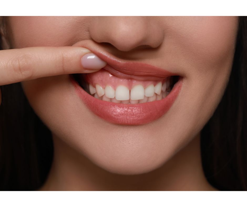 和光市 歯医者 和光市デンタルオフィス 歯茎が腫れたとき痛いとき