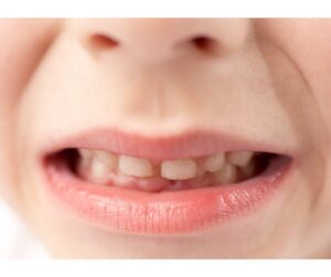 和光市　歯医者　和光市デンタルオフィス　MFT　食育　