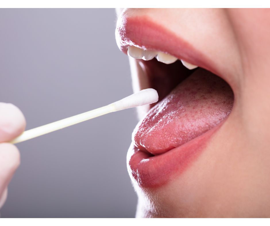 和光市 歯医者 和光市デンタルオフィス すぐ虫歯になる