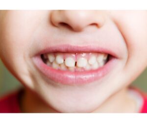 和光市　歯医者　和光市デンタルオフィス　MFT　食育　