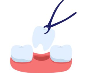 和光市　歯医者　和光市デンタルオフィス　歯を失う理由