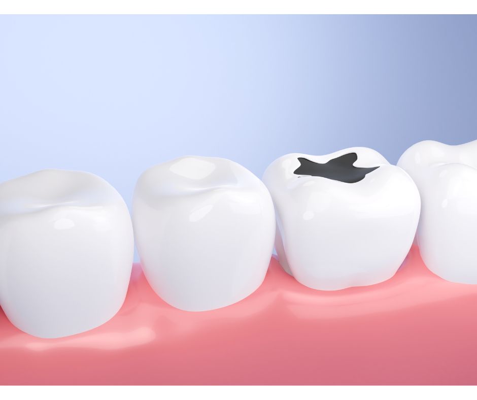 和光市　歯医者　和光市デンタルオフィス　歯を失わない予防