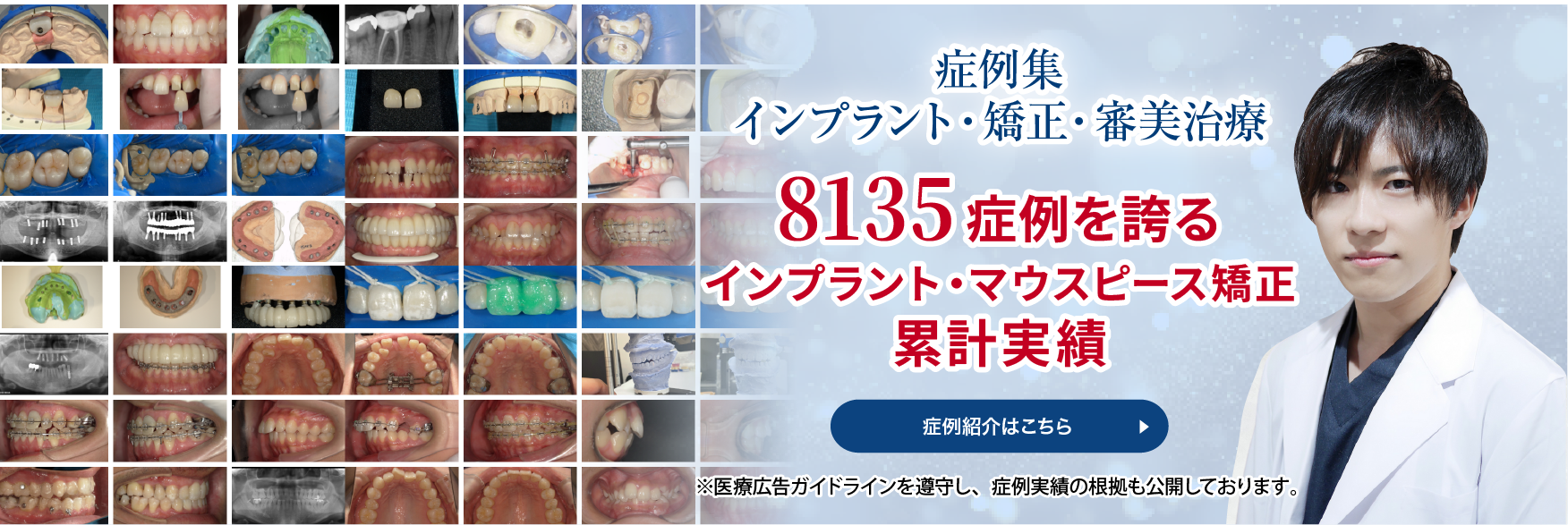 和光市デンタルオフィス 症例紹介