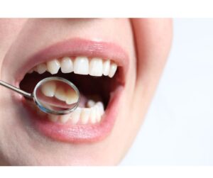 和光市　歯医者　和光市デンタルオフィス 歯の見た目