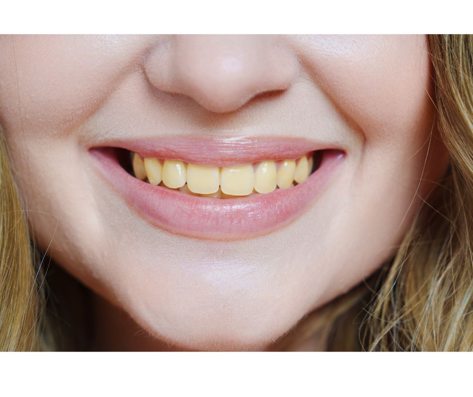 和光市 歯医者 和光市デンタルオフィス コーヒー 黄ばむ