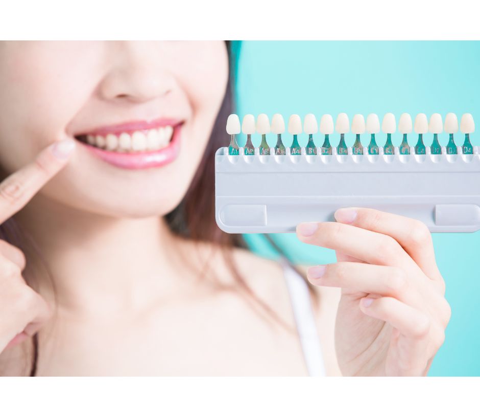 和光市 歯医者 和光市デンタルオフィス 白濁 ホワイトスポット icon治療