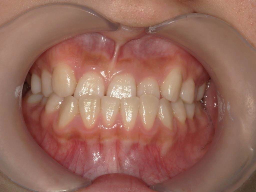 和光市　歯医者　矯正歯科　MSE