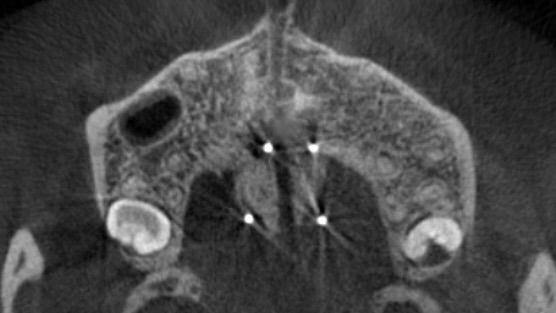 和光市　歯医者　矯正歯科　MSE