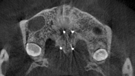 和光市　歯医者　矯正歯科　MSE